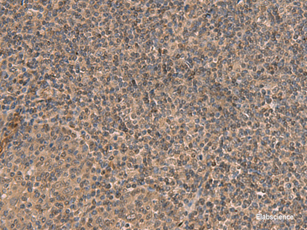 Immunohistochemistry of paraffin-embedded Human tonsil tissue  using HEBP2 Polyclonal Antibody at dilution of 1:70(×200)