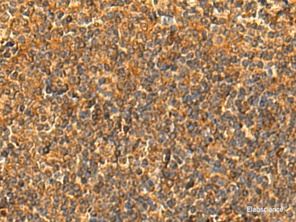 Immunohistochemistry of paraffin-embedded Human tonsil tissue  using HS1BP3 Polyclonal Antibody at dilution of 1:50(×200)