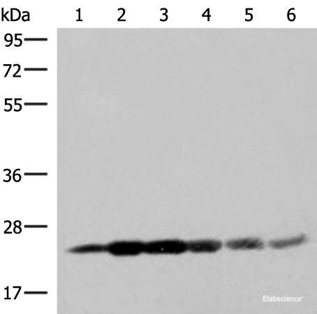 Western blot analysis of 293T cell lysates  using GSTK1 Polyclonal Antibody at dilution of 1:250