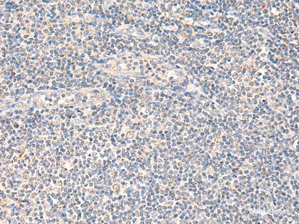 Immunohistochemistry of paraffin-embedded Human tonsil tissue  using NEGR1 Polyclonal Antibody at dilution of 1:90(×200)
