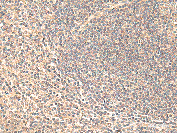 Immunohistochemistry of paraffin-embedded Human tonsil tissue  using SULT4A1 Polyclonal Antibody at dilution of 1:65(×200)