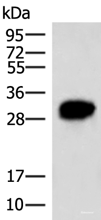 Western blot analysis of HepG2 cell lysate  using HCCS Polyclonal Antibody at dilution of 1:4000