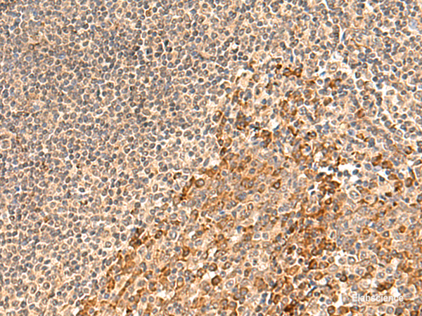 Immunohistochemistry of paraffin-embedded Human tonsil tissue  using GALNT12 Polyclonal Antibody at dilution of 1:60(×200)