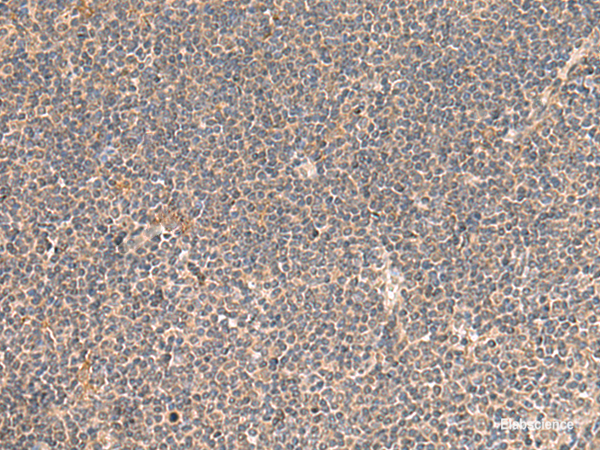 Immunohistochemistry of paraffin-embedded Human tonsil tissue  using KCNE3 Polyclonal Antibody at dilution of 1:55(×200)