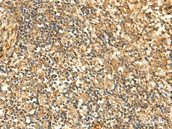 Immunohistochemistry of paraffin-embedded Human tonsil tissue  using GLYATL2 Polyclonal Antibody at dilution of 1:50(×200)