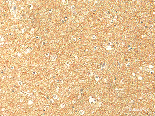 Immunohistochemistry of paraffin-embedded Human brain tissue  using RNF148 Polyclonal Antibody at dilution of 1:50(×200)