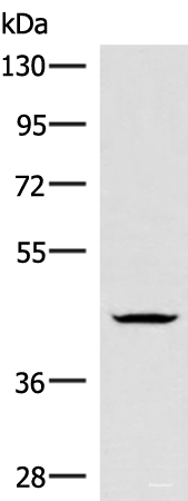 Western blot analysis of Jurkat cell lysate  using HMBOX1 Polyclonal Antibody at dilution of 1:300