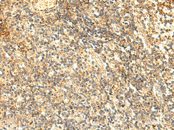 Immunohistochemistry of paraffin-embedded Human tonsil tissue  using NAPRT Polyclonal Antibody at dilution of 1:50(×200)