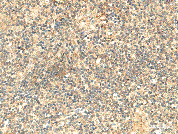 Immunohistochemistry of paraffin-embedded Human tonsil tissue  using NTAN1 Polyclonal Antibody at dilution of 1:50(×200)