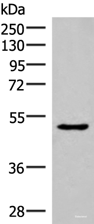 Western blot analysis of Mouse Pancreas tissue lysate  using NKD2 Polyclonal Antibody at dilution of 1:350