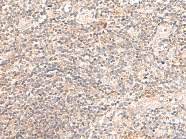 Immunohistochemistry of paraffin-embedded Human tonsil tissue  using TRAPPC1 Polyclonal Antibody at dilution of 1:50(×200)
