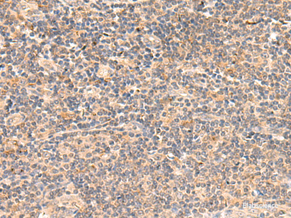 Immunohistochemistry of paraffin-embedded Human tonsil tissue  using TEAD3 Polyclonal Antibody at dilution of 1:50(×200)