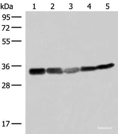 Western blot analysis of 293T HepG2 and A549 cell lysates  using ECH1 Polyclonal Antibody at dilution of 1:200