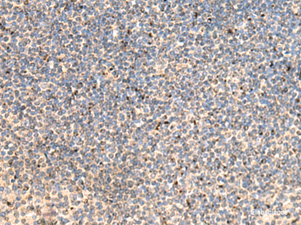 Immunohistochemistry of paraffin-embedded Human tonsil tissue  using PTH1R Polyclonal Antibody at dilution of 1:65(×200)