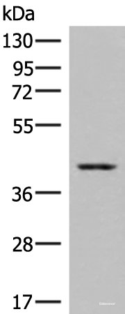 Western blot analysis of Human placenta tissue lysates  using DHPS Polyclonal Antibody at dilution of 1:550