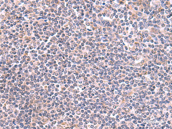 Immunohistochemistry of paraffin-embedded Human tonsil tissue  using GMDS Polyclonal Antibody at dilution of 1:70(×200)