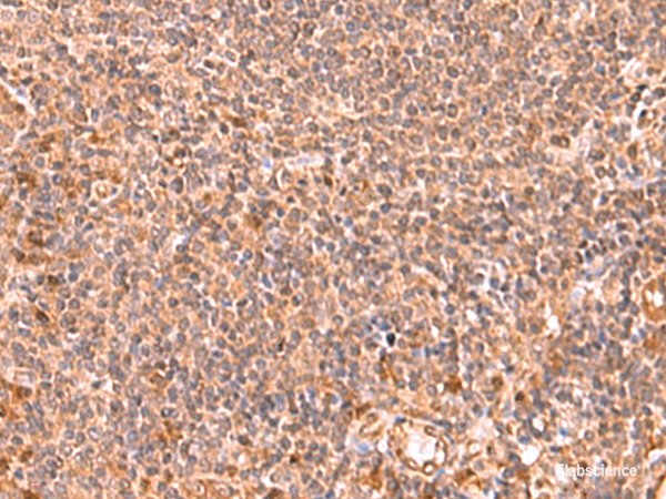 Immunohistochemistry of paraffin-embedded Human tonsil tissue  using RABEPK Polyclonal Antibody at dilution of 1:85(×200)