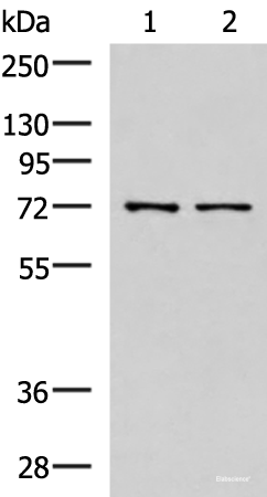 Western blot analysis of Mouse liver tissue and Jurkat cell lysates  using MKS1 Polyclonal Antibody at dilution of 1:700