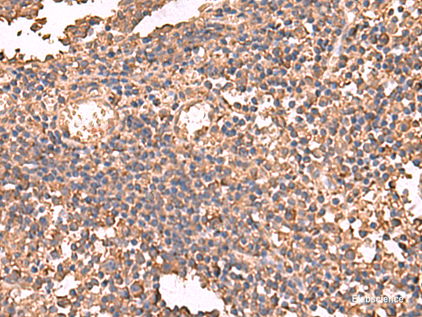 Immunohistochemistry of paraffin-embedded Human tonsil tissue  using LDHAL6B Polyclonal Antibody at dilution of 1:65(×200)