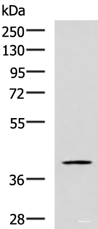 Western blot analysis of TM4 cell lysate  using RAB3IL1 Polyclonal Antibody at dilution of 1:600