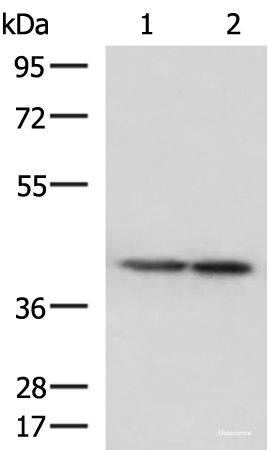 Western blot analysis of Human cerebella tissue and Human cerebrum tissue lysates  using ATP6V1C1 Polyclonal Antibody at dilution of 1:500