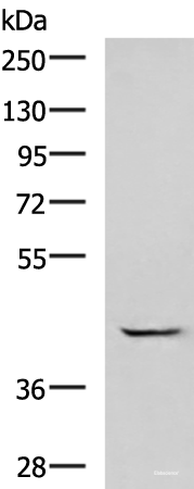 Western blot analysis of A549 cell lysate  using GABPB1 Polyclonal Antibody at dilution of 1:1000