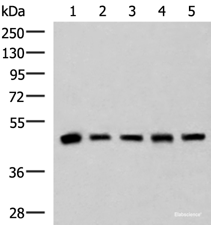 Western blot analysis of Human fetal liver tissue HepG2 A172 Hela and Jurkat cell lysates  using PCYT2 Polyclonal Antibody at dilution of 1:800