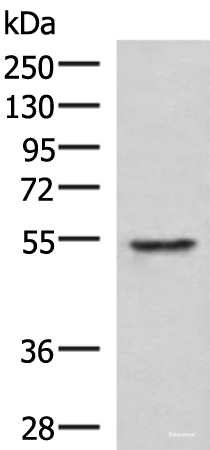 Western blot analysis of Jurkat cell lysate  using TUBD1 Polyclonal Antibody at dilution of 1:1000