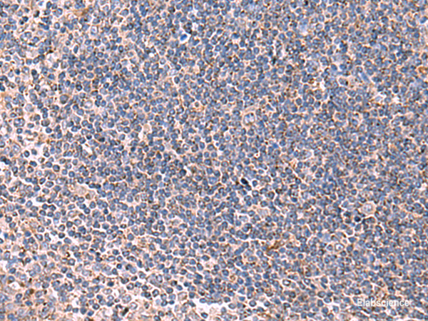Immunohistochemistry of paraffin-embedded Human tonsil tissue  using LIPA Polyclonal Antibody at dilution of 1:85(×200)