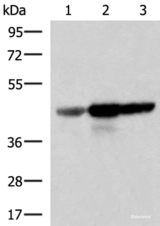 Western blot analysis of Human fetal brain tissue HepG2 and HT29 cell lysates  using FDFT1 Polyclonal Antibody at dilution of 1:1000