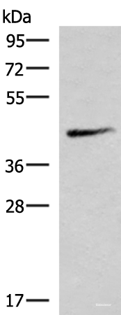 Western blot analysis of Mouse lung tissue lysate  using SMPD2 Polyclonal Antibody at dilution of 1:1000