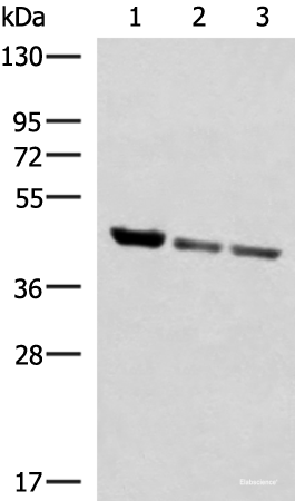 Western blot analysis of Human fetal liver tissue PC-3 and A172 cell lysates  using SCCPDH Polyclonal Antibody at dilution of 1:1000