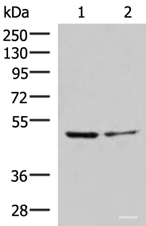 Western blot analysis of Jurkat and HepG2 cell lysates  using ECSIT Polyclonal Antibody at dilution of 1:1000