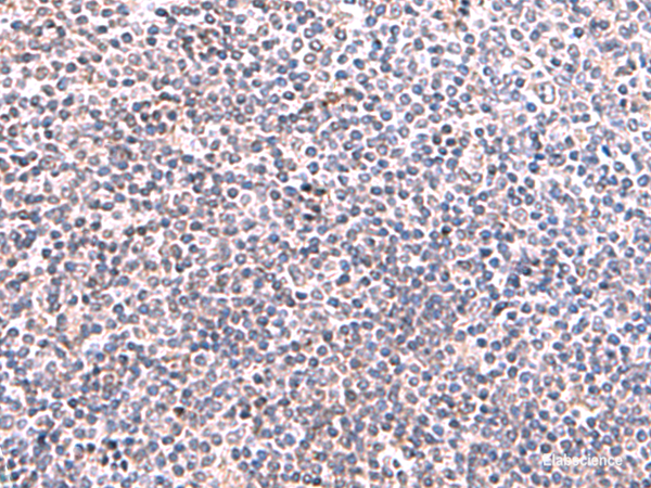 Immunohistochemistry of paraffin-embedded Human tonsil tissue  using KIR3DL1 Polyclonal Antibody at dilution of 1:95(×200)