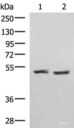 Western blot analysis of Human cerebella tissue K562 cell lysates  using RRP8 Polyclonal Antibody at dilution of 1:1000