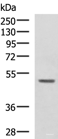 Western blot analysis of 293T cell lysate  using GALK2 Polyclonal Antibody at dilution of 1:1350