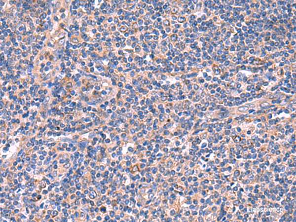 Immunohistochemistry of paraffin-embedded Human tonsil tissue  using MPP1 Polyclonal Antibody at dilution of 1:50(×200)