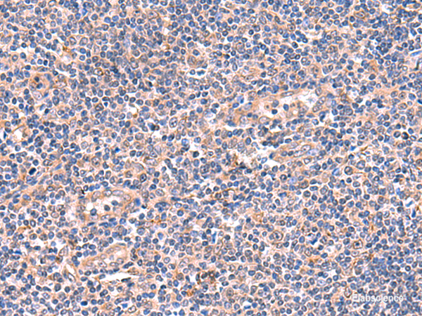 Immunohistochemistry of paraffin-embedded Human tonsil tissue  using OSBPL2 Polyclonal Antibody at dilution of 1:55(×200)