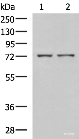 Western blot analysis of Mouse liver tissue and Jurkat cell lysates  using ZAP70 Polyclonal Antibody at dilution of 1:800