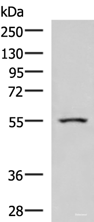 Western blot analysis of Human heart tissue lysate  using ARIH2 Polyclonal Antibody at dilution of 1:1000