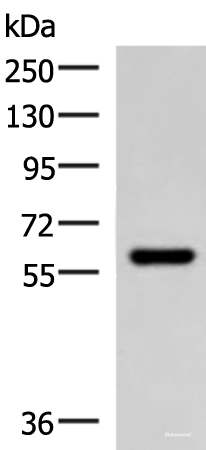 Western blot analysis of Mouse skeletal muscle tissue lysate  using MYOT Polyclonal Antibody at dilution of 1:900