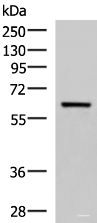 Western blot analysis of Human fetal brain tissue lysate  using SARS Polyclonal Antibody at dilution of 1:850