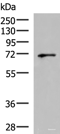 Western blot analysis of PC3 cell lysate  using GSPT2 Polyclonal Antibody at dilution of 1:600