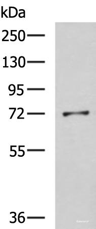 Western blot analysis of K562 cell lysate  using GSTCD Polyclonal Antibody at dilution of 1:800