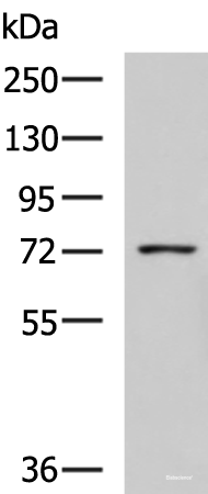 Western blot analysis of K562 cell lysate  using GUSB Polyclonal Antibody at dilution of 1:800