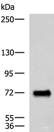 Western blot analysis of Human fetal brain tissue lysate  using PPEF1 Polyclonal Antibody at dilution of 1:1500