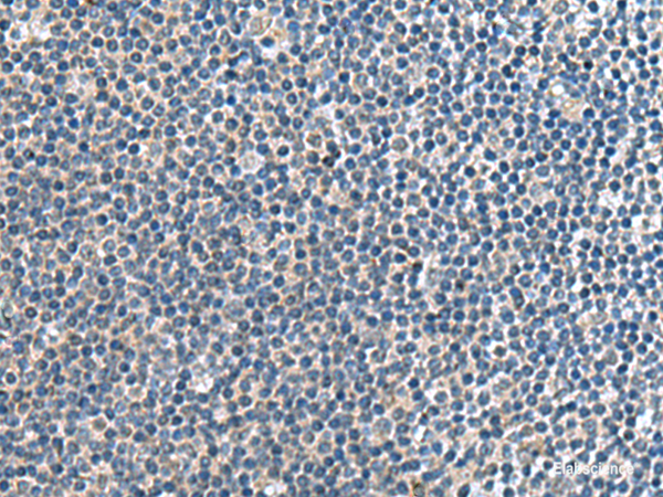 Immunohistochemistry of paraffin-embedded Human tonsil tissue  using CNTN4 Polyclonal Antibody at dilution of 1:65(×200)