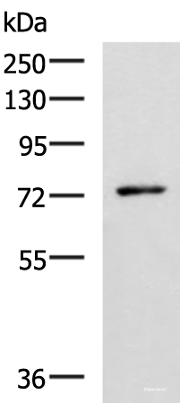 Western blot analysis of Mouse thymus tissue lysate  using L3MBTL2 Polyclonal Antibody at dilution of 1:1000