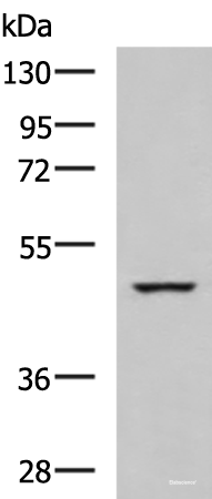 Western blot analysis of K562 cell lysate  using IP6K2 Polyclonal Antibody at dilution of 1:650