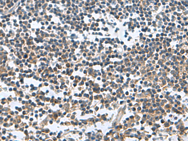 Immunohistochemistry of paraffin-embedded Human tonsil tissue  using FAM107B Polyclonal Antibody at dilution of 1:150(×200)